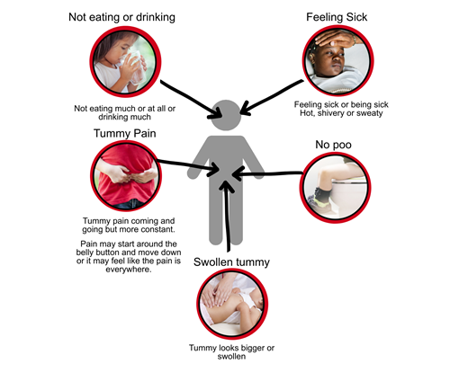 Serious illness graphic. Tummy pain. One symptom. talk to a health professional today, more than one symptom, call your gp or 111 straight away - Not eating or drinking, feeling sick, tummy pain, swollen tummy, no poo.