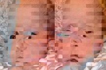 Photograph of a baby looking at the camera with a subtle white shade in the pupil of their right eye.